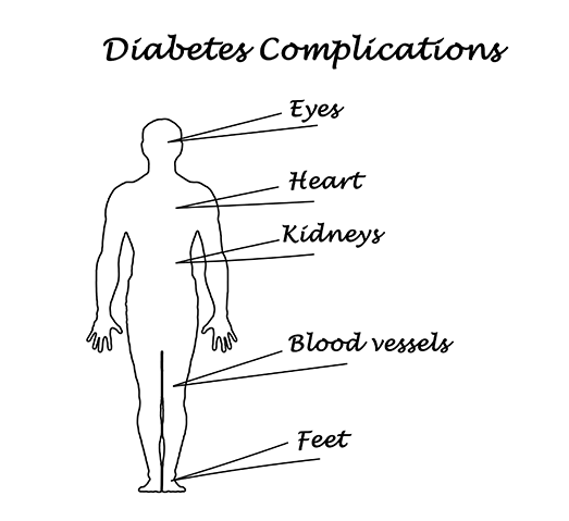 Diabetes Complications